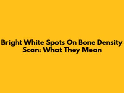 Bright White Spots On Bone Density Scan: What They Mean
