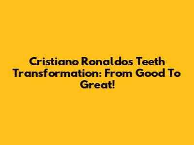 Cristiano Ronaldo's Teeth Transformation: From Good To Great!