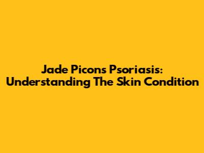 Jade Picon's Psoriasis: Understanding The Skin Condition