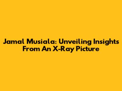 Jamal Musiala: Unveiling Insights From An X-Ray Picture