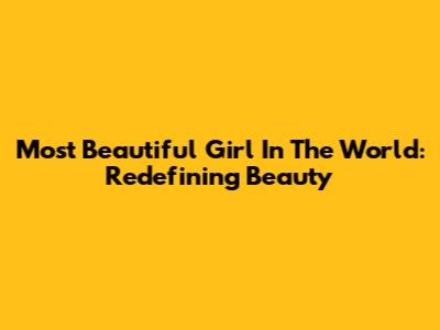 Most Beautiful Girl In The World: Redefining Beauty