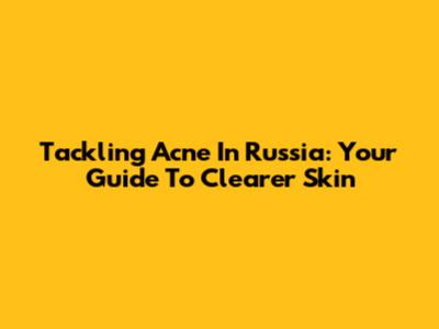 Tackling Acne In Russia: Your Guide To Clearer Skin
